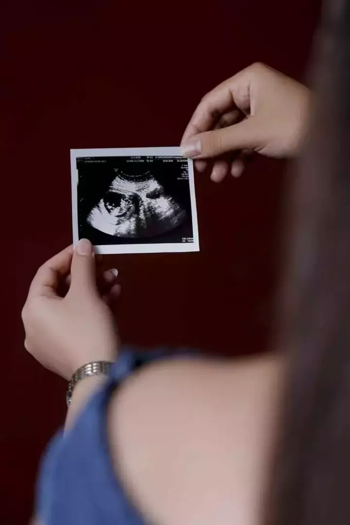 عکاسی بارداری از محیا شفیعی