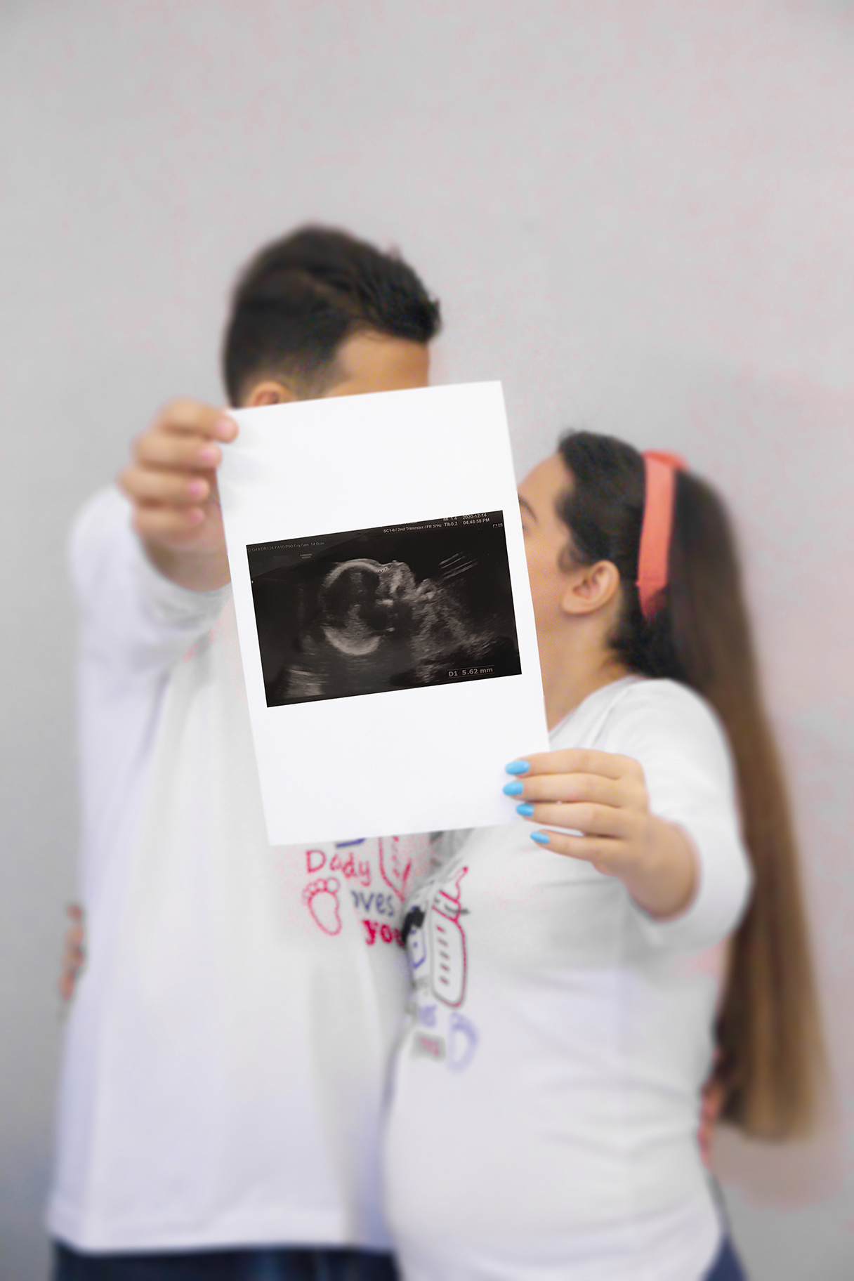 ژست عکس بارداری