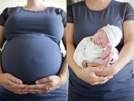 عکس قبل و بعد بارداری